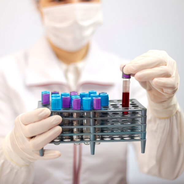 Triple-S realiza estudio epidemiológico de empleados y sus familiares